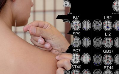 How Acupuncture Works: an overview